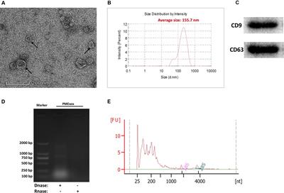 Exploration of Long Non-coding RNAs and Circular RNAs in Porcine Milk Exosomes